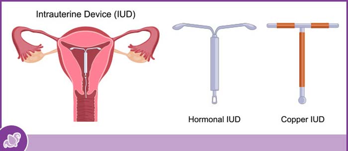 The Benefits of Using an IUD for Birth Control | Cobb Women’s Health Near Me in Austell GA The Benefits of Using an IUD for Birth Control | Cobb Women’s Health Near Me in Austell GA